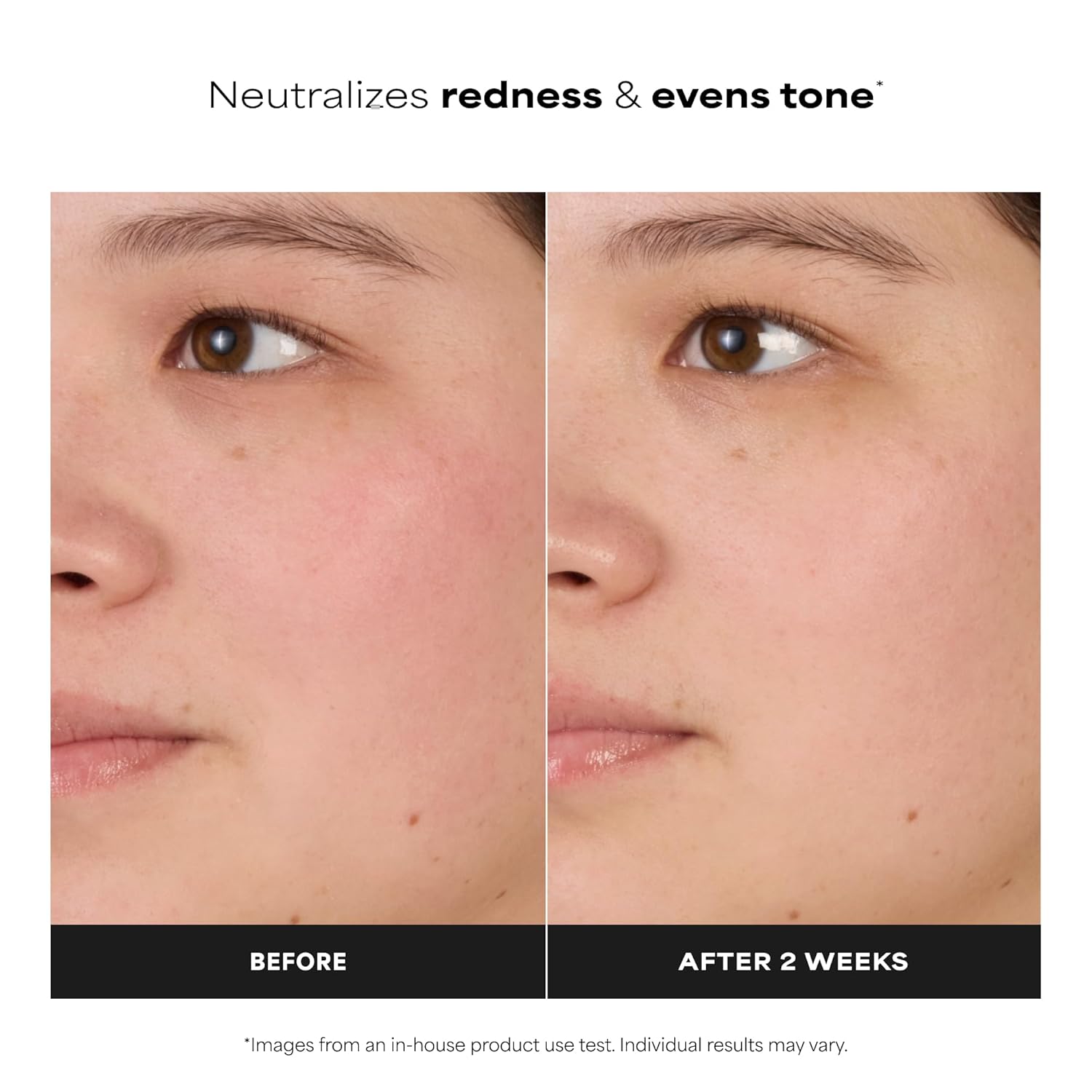 Clear Skin Balancing Toner