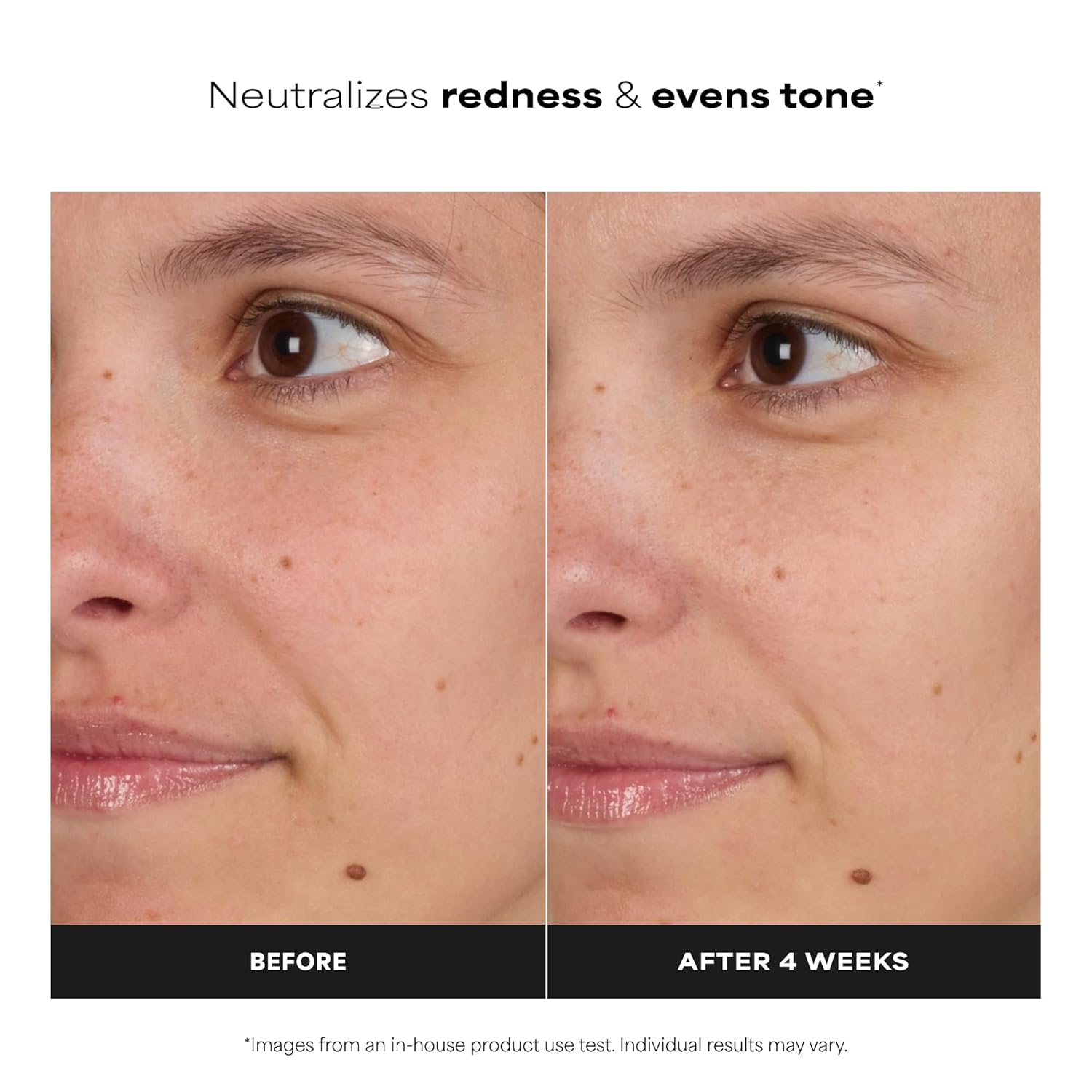 Clear Skin Balancing Toner