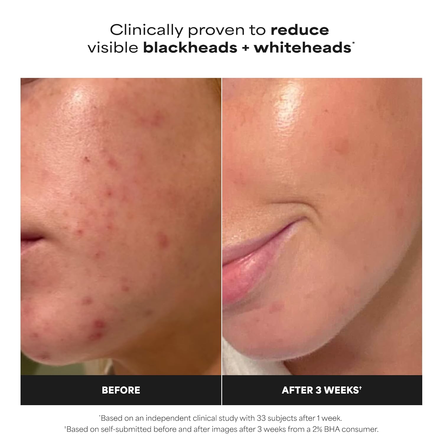 Radiant Glow Skin Polish