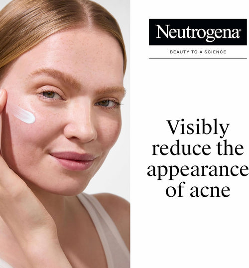 Clear Skin Acne Spot Gel